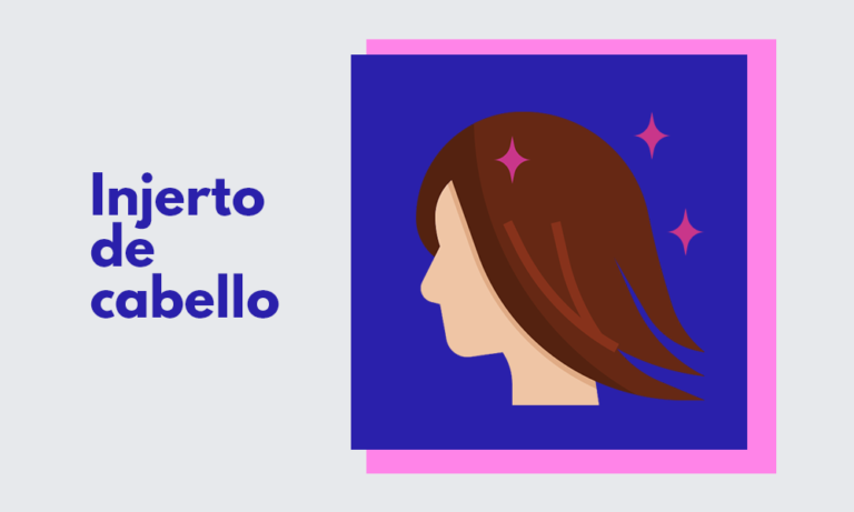 injerto de cabello para mujeres implante capilar